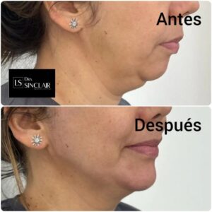 cliente-1-1024x1024