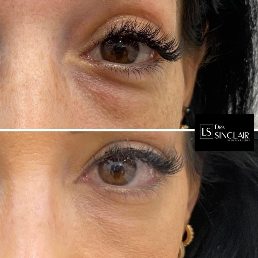 cliente-10-1024x1024