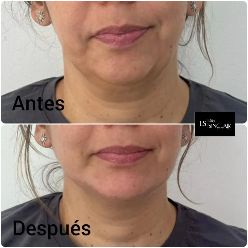 cliente-2-1024x1024