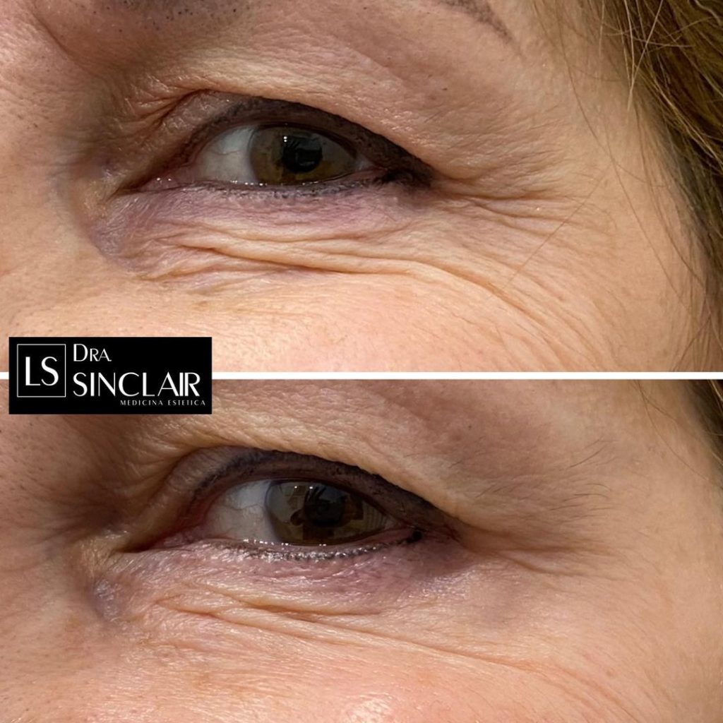 cliente-6-1024x1024