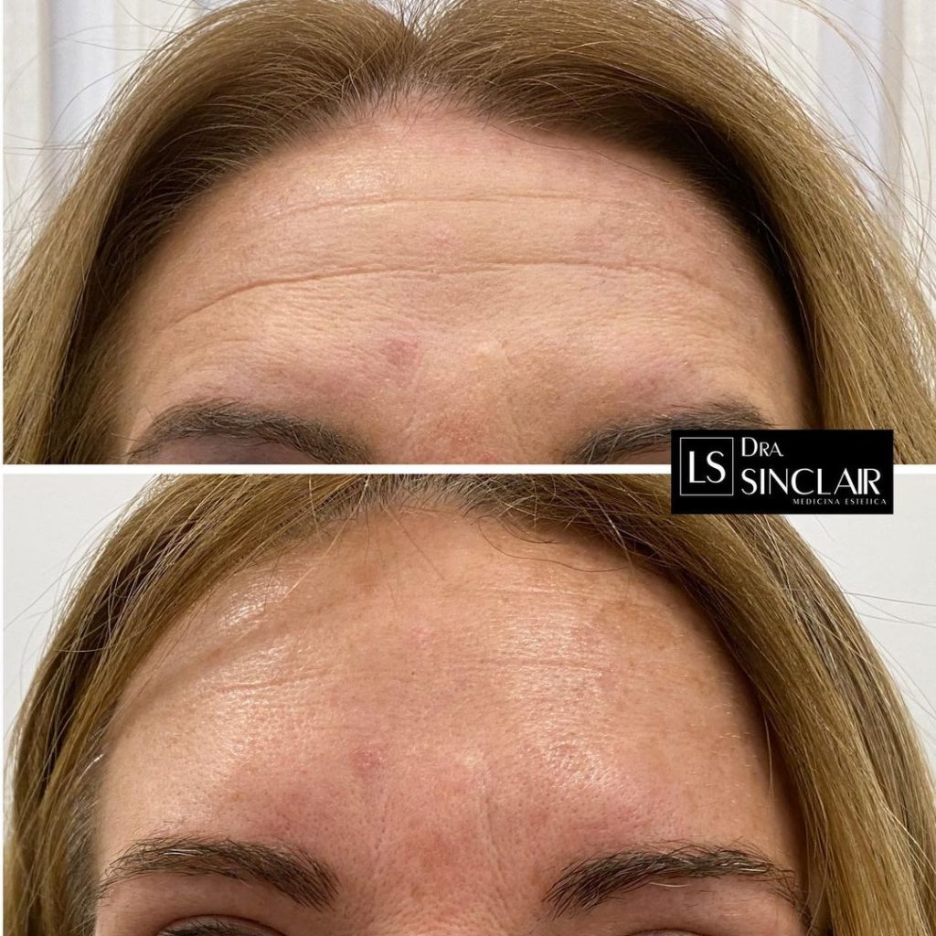 cliente-7-1024x1024