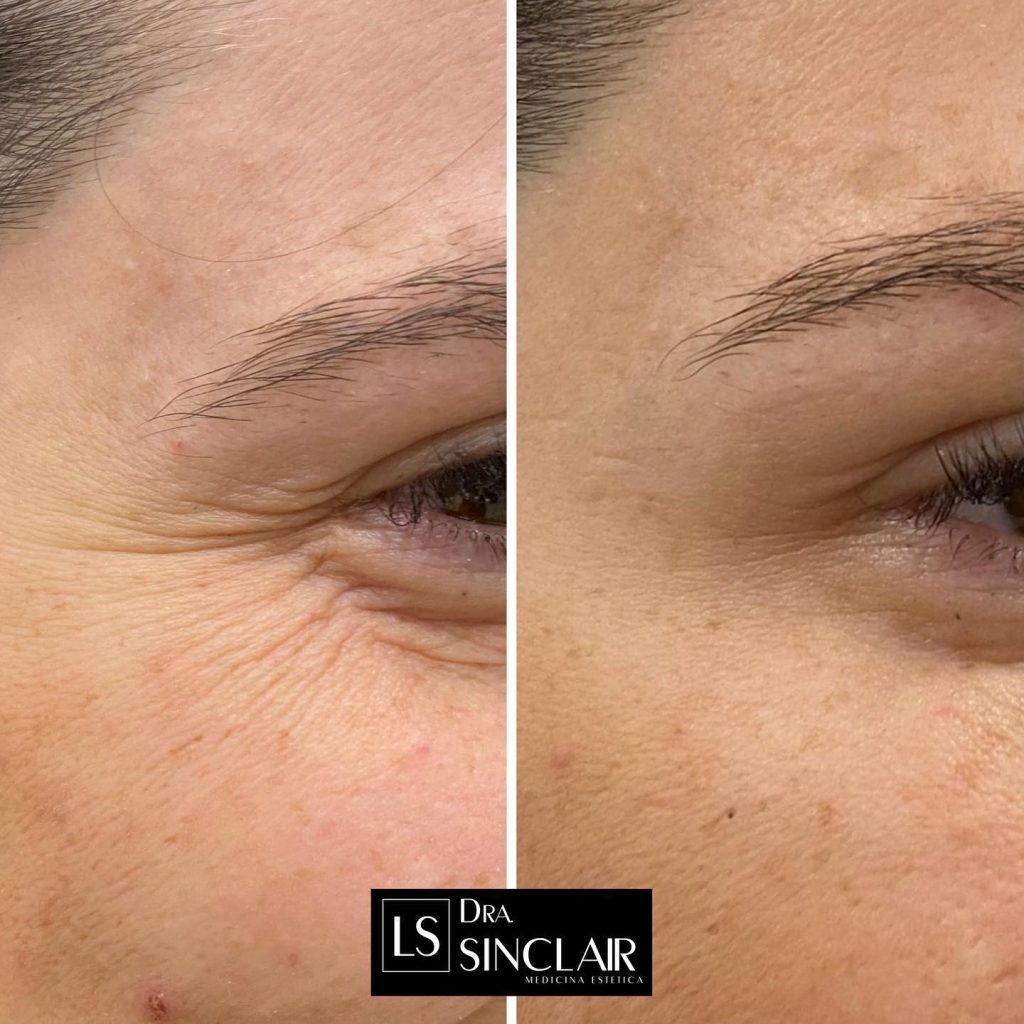 cliente-8-1024x1024