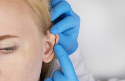 The girl at the reception at the plastic surgeon, shows the auricle. Darwin's tubercle on the ear.